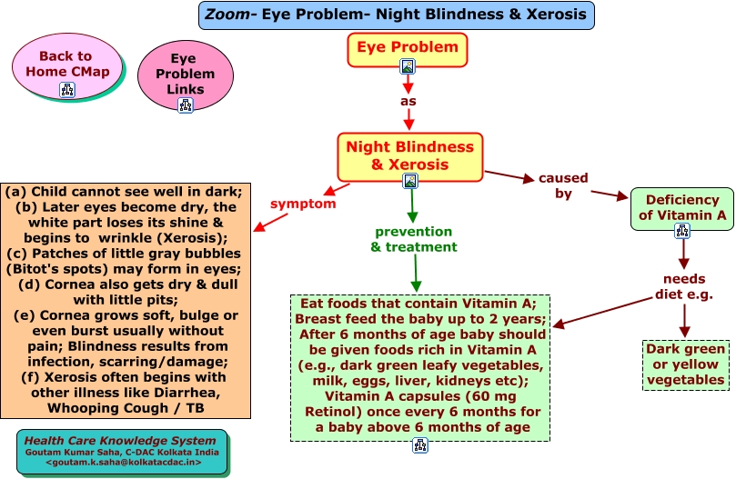 Zoom-Eye Problem-Night Blindness- Xerosis.html